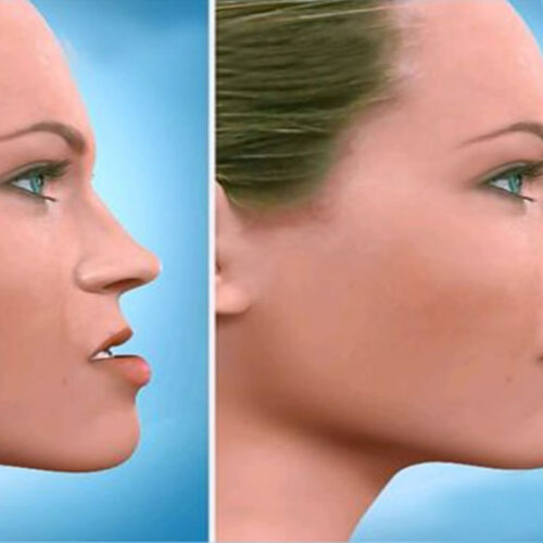 Cirugía maxilofacial