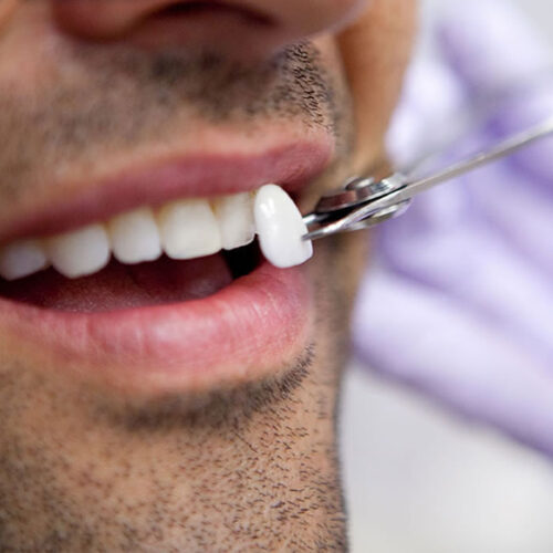 Estética dental
